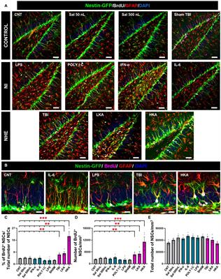 The differential response to neuronal hyperexcitation and neuroinflammation of the hippocampal neurogenic niche